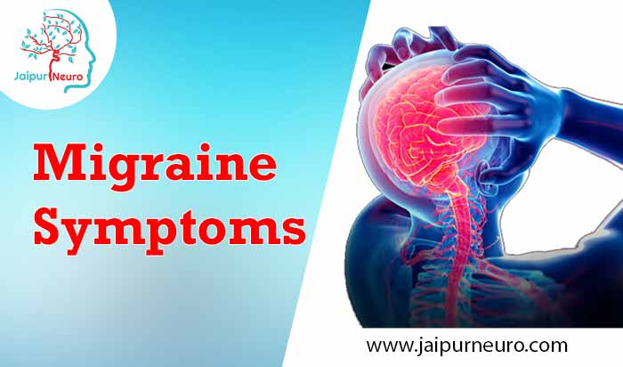 Migraine Symptoms