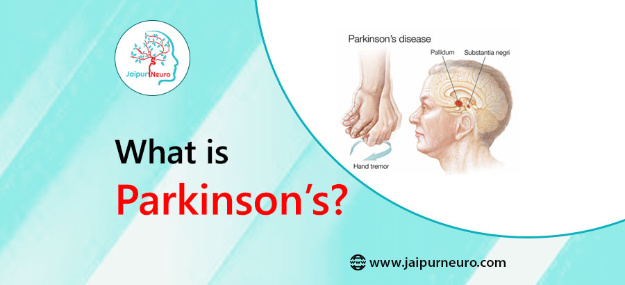 Parkinsons