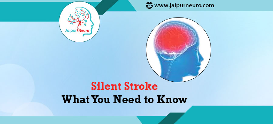 Silent Stroke
