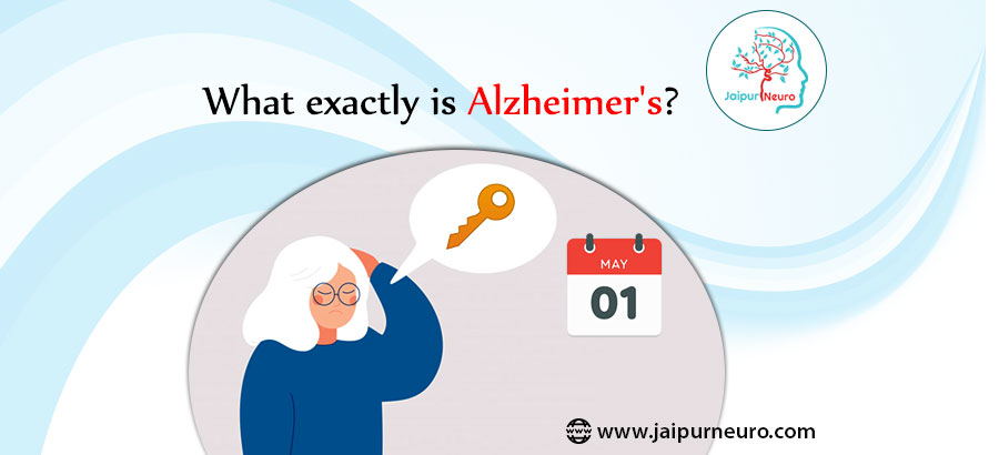 What exactly is Alzheimer's?