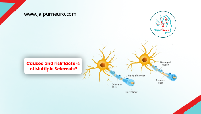 Risk factor of Multiple Sclerosis