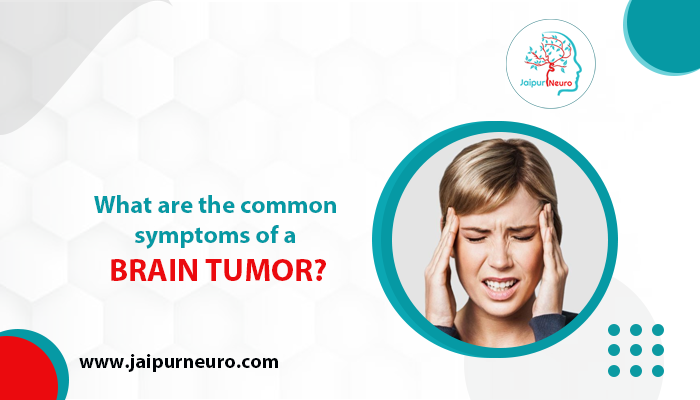Common Symptoms of a Brain Tumor