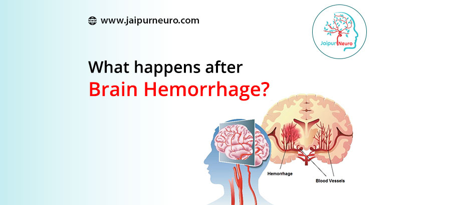 What Happens After Brain Haemorrhage
