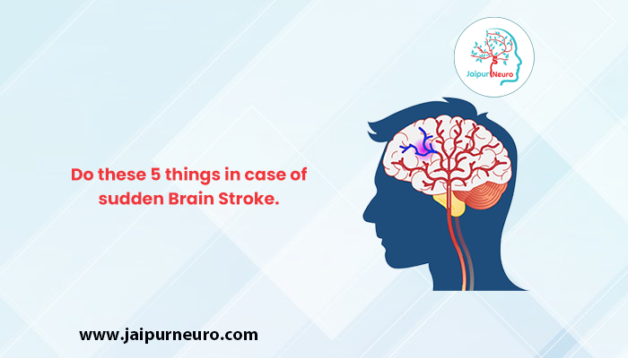 5 things in case of sudden Brain Stroke