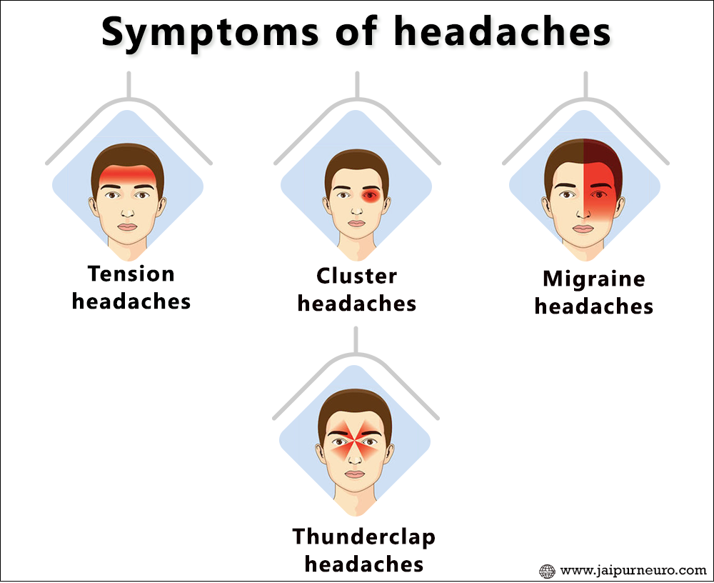 Cluster Headache Hindi
