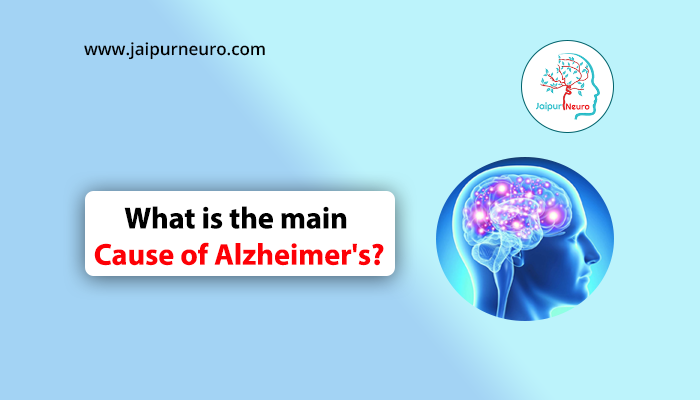 Main Cause of Alzheimer’s