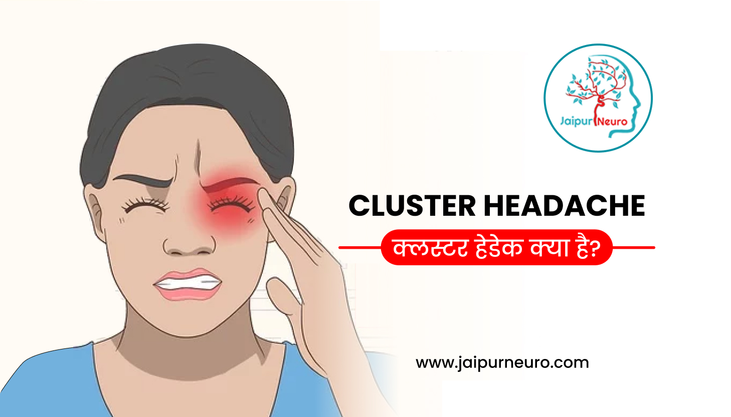 Cluster Headache Hindi