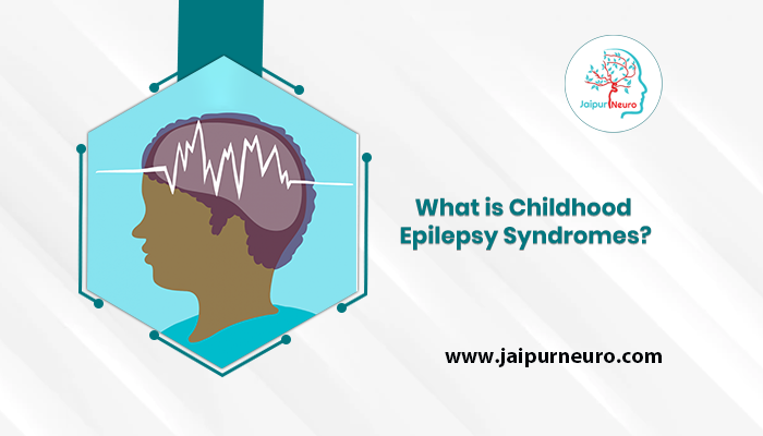 Childhood Epilepsy Syndromes