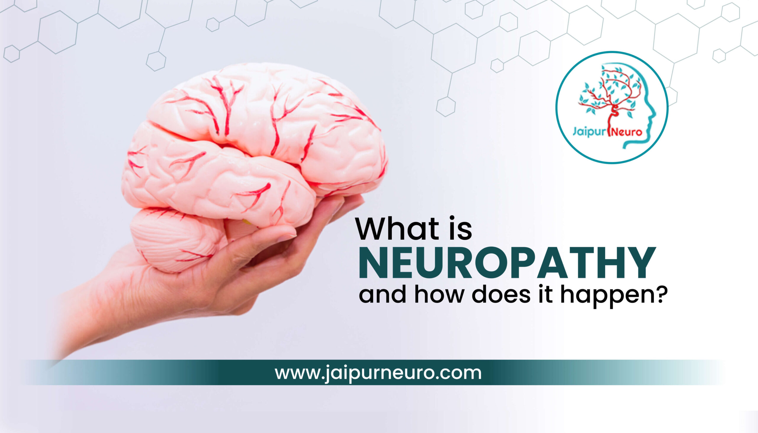 What is Neuropathy