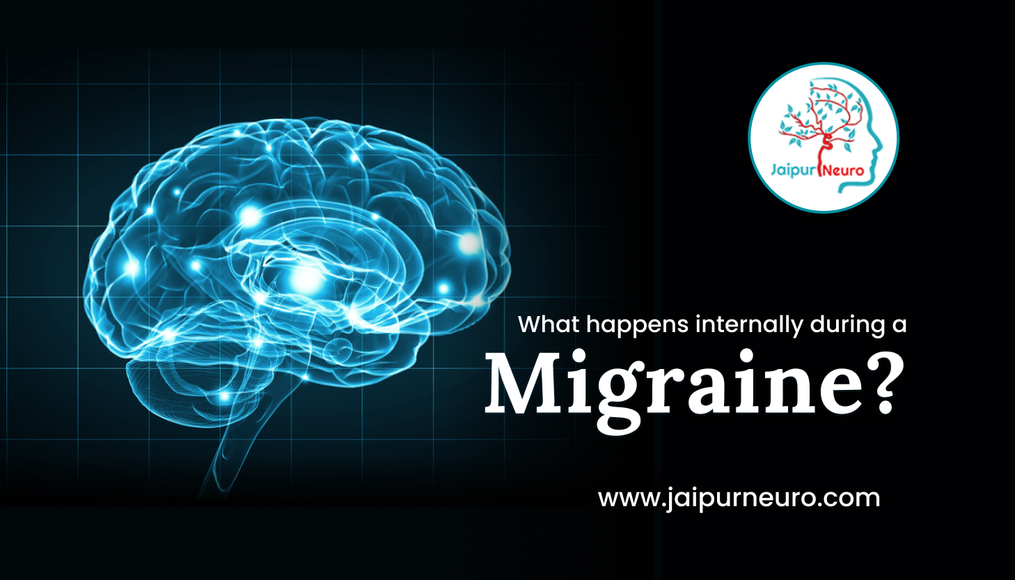 What happens internally during a migraine