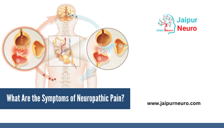 Symptoms of Neuropathic Pain