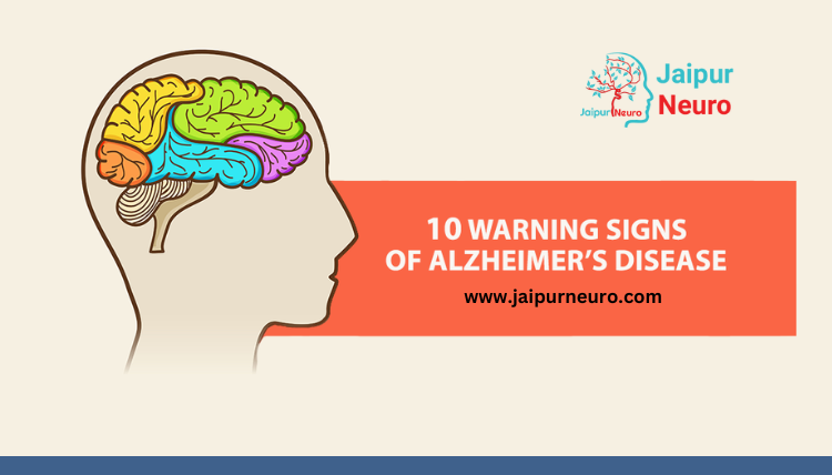 Warning Signs of Alzheimer's Disease