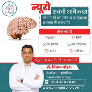 10 Symptoms That You Must Visit Neurologist