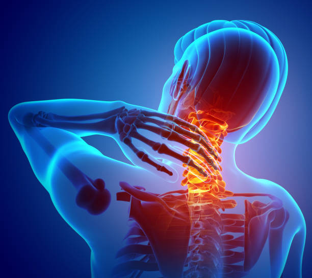  What is neck pain?